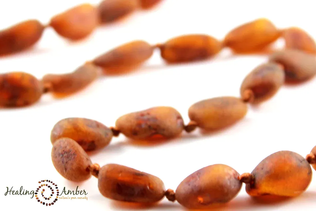 Baltic Amber Necklaces - 17.5"